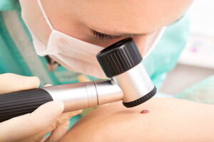 Tips to Choose Skin Cancer Check Brisbane